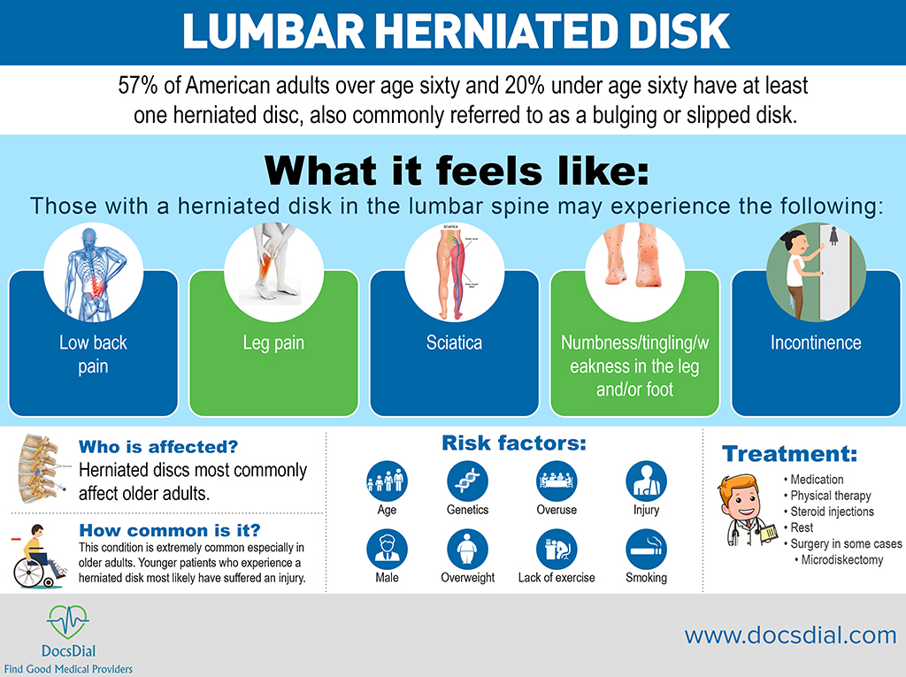 Herniated Disc and Symptoms (Infographic)